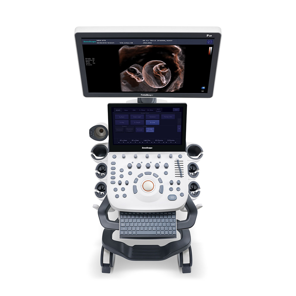 CONSERTO TRANSDUTOR SONOSCAPE P20 BRASIL