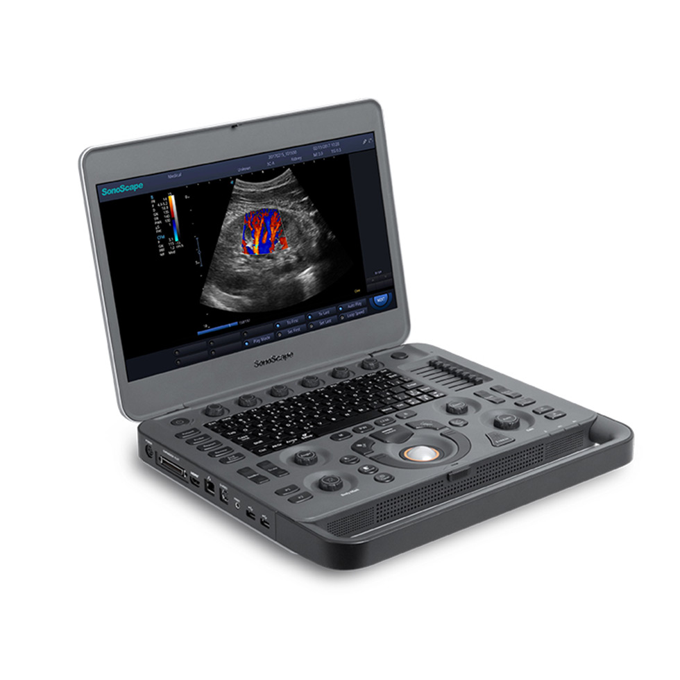 PLACA E PEÇAS TRANSDUTOR SONOSCAPE X3 GOIAS